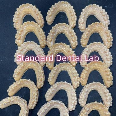 Los retentores ortodónticos profesionales de invisalign transparentes