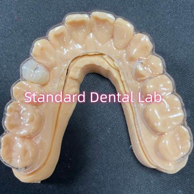 Conservadores ortodónticos profesionales con dientes de resina acrílica estables