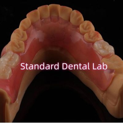 Alta estética Flexible Valplast Dentadura parcial fácil de limpiar