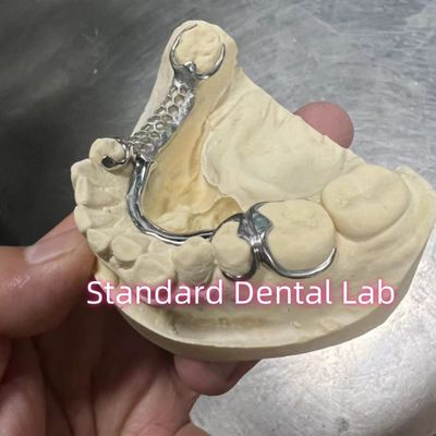 Esqueleto de cromo con dentadura parcial fundida marco de metal ISO