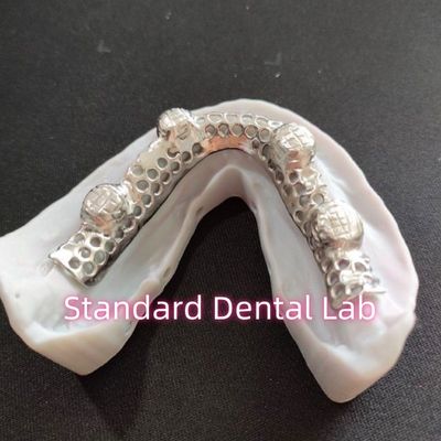 Cuadro metálico de cobalto cromo fundido Dentadura parcial con marco metálico