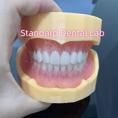 Alta estética con dentaduras de acrílico superior e inferior con dentaduras de color rosa
