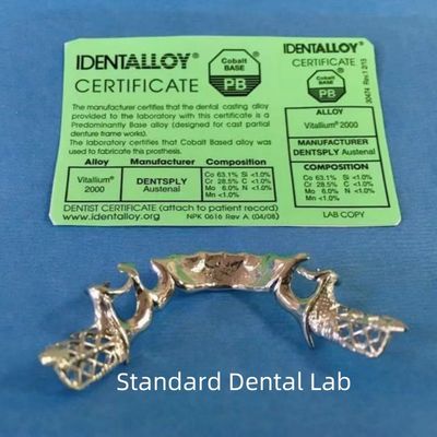 MetalVitallio Dentadura parcial Níquel y aleación de cobalto de cromo libre de berilio