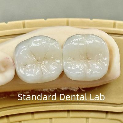 Coronas de laboratorio dentales translúcidas de contorno completo de zircón con una resistencia superior