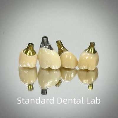 Coroa de implante con tornillo de zirconio profesional de titanio CAD CAM