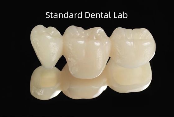 CAD CAM Vacío PMMA Puente temporario dental provisional