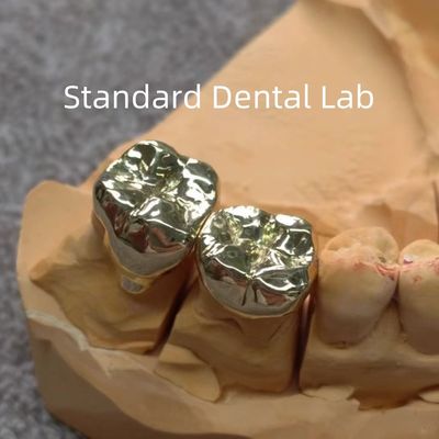 Coronas de oro dentales amarillas de alto Nobel Profesional Ni Be Free ISO aprobado