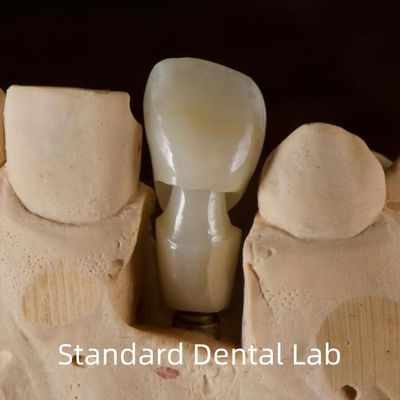 Implante dental Tibase Abutment de zirconia Titanio Precisión personalizada