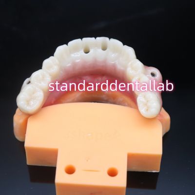 Puente de implantes dentales de zirconia de color dental biocompatible