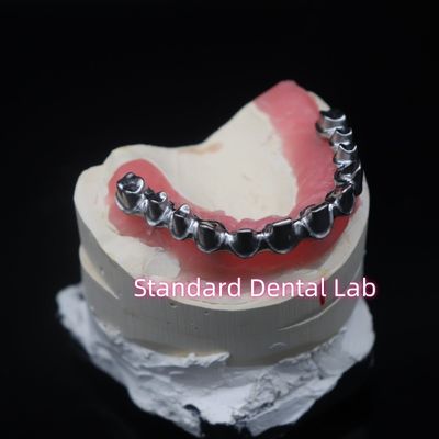 Full Arch Malo Puente Restauración dental Circonia Coronas con goma Poecelian China Dental Laboratorio