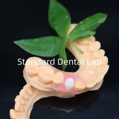 Estética Valplast Dentes flexibles con política de rehabilitación gratuita en 3 días China Dental Lab