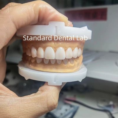Perfecta Estética Cera Provisional para Dentistas que usan cera dental de China Dental Lab
