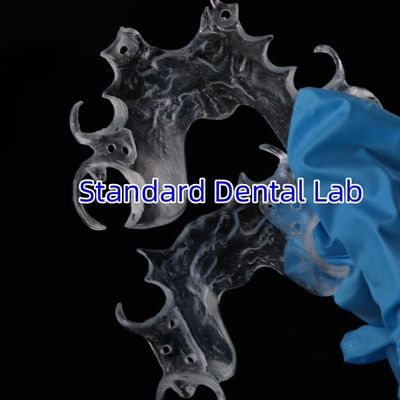 Cuadro claro Acrílico Metal Cuadros de dentadura parcial Alta estética Laboratorio dental de China