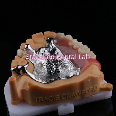 Cuadro de fundición superior Dentes parciales de acrílico de metal Fuerte Ligero y duradero
