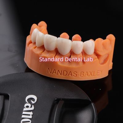 Comodidad y funcionalidad con CAD digital CAM Laboratorio dental Puente de zirconia translúcido en capas
