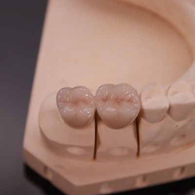 Confortable corona de zircón con acabado estético preciso Express 3-4 días Tiempo de entrega