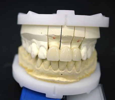 Puente de la corona de zirconio de precisión ajuste cómodo / estética 3-4 días Tiempo de respuesta rápido