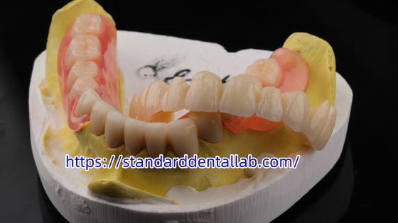 Alta estética Dental TCS Valplast Flexible Dentaduras parciales Dental Laboratorio Valplast Cerradura Tinta rosa