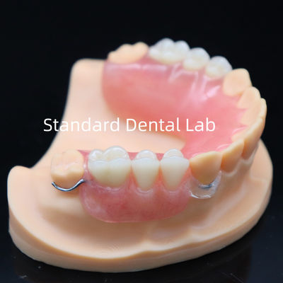 Alta estética dentadura parcial acrílica con cierre transparente y dientes acrílicos China Dental Lab