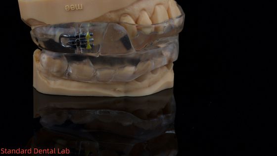 Dispositivo de sueño dorsal personalizable Dispositivo contra ronquidos para dormir tranquilo Laboratorio dental de China