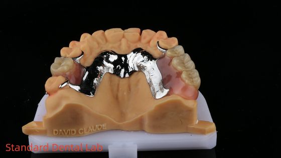 CorCr Dentadura parcial de metal Alta luz libre de berilio Ivoclar Scheftner Cuadro de metal cómodo