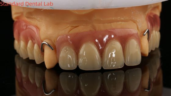 Dentadura parcial de acrílico con curación térmica Laboratorio dental de alta precisión con modelo de impresión 3D