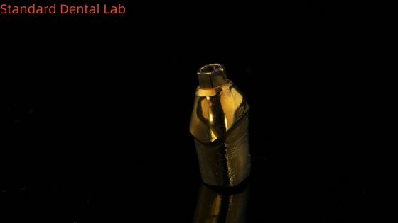 Abutments de titanio puro La solución perfecta para la restauración dental