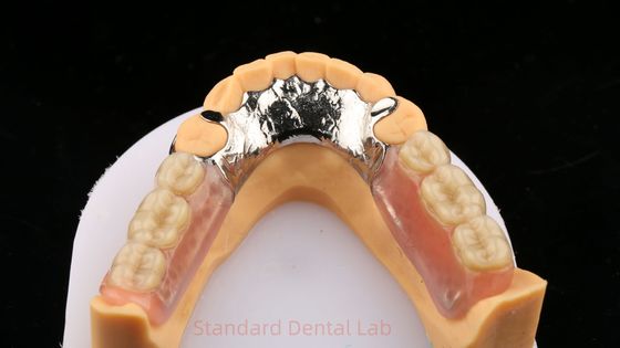 Las aleaciones metálicas de cobalto cromo Dentadura parcial Ivoclar Scheftner Confortable marco de metal fundido
