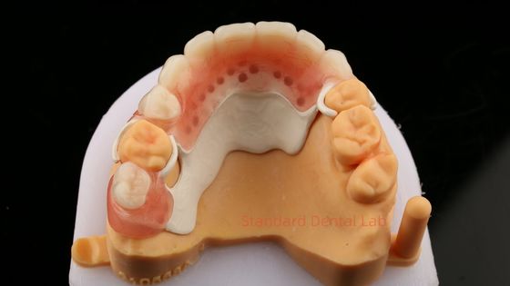 Peek Diseño del marco parcial ISO CE y FDA Laboratorio dental Acrílico marco de dentadura parcial