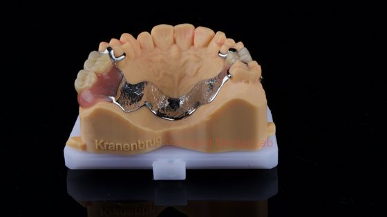 Dentaduras parciales de cobalto cromo Ivoclar Scheftner Cuadro de metal cómodo entregado en sólo 3 días