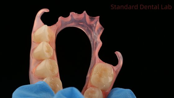Dental TCS Valplast Flexible Dentes parciales Dental Laboratorio Impresión 3D Modelo de alta estética