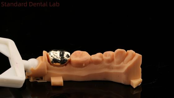 El dentista profesional de la corona de oro amarillo de alto Nobel Ni Be Free ISO y FDA aprobado por el laboratorio dental chino