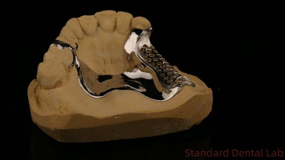 Cuadro de fundición impreso en 3D de alta resistencia COCR Dentaduras parciales Cromo Cobalto Cuadro de fundición de metal