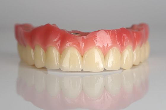 Puente de implantes de zirconio de arco completo Todos en cuatro / Todos en seis Implantes dentales Recuperación rápida