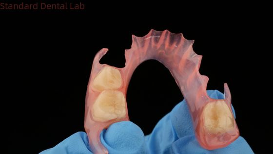 Modelo de impresión 3D Dental TCS Valplast Flexibles Dentaduras Parciales Color Rosa / Oscuro Producto de laboratorio dental