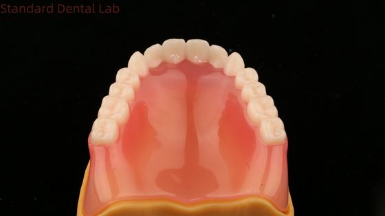 Dentadura completa Ivoclar Dentadura completa Dientes acrílicos SDL Laboratorio Dental