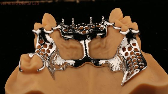 Cuadro de fundición superior Dentes parciales de acrílico de metal Fuerte Ligero y duradero