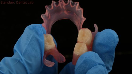 Dental TCS Valplast Flexible Dentes parciales Nesbit Valplast Finish China Valplast cerradura de laboratorio dental