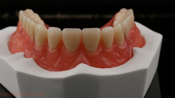 Dentsply Lucitone 199 Dentadura acrílica para una apariencia natural de arco completo