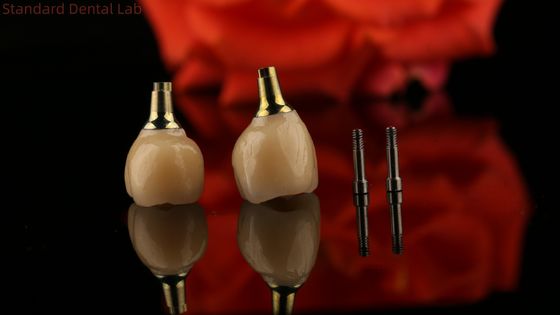 Implante de tornillo retenido de porcelana de cemento de zirconia Forma de cabeza hexagonal para estética de ajuste personalizado