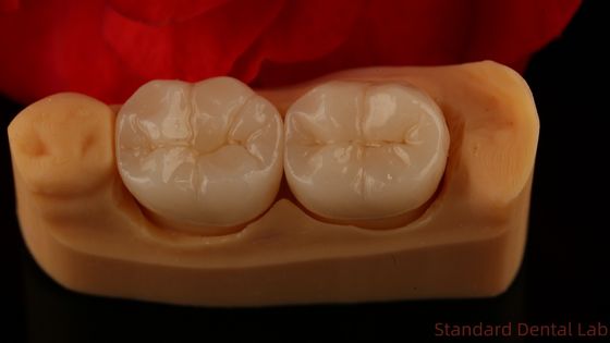 Coronilla de zirconio de contorno completo Fuerza y estética excepcionales Sin recubrimiento de porcelana Coronilla posterior Laboratorio dental de China