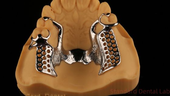 Las aleaciones metálicas parcialmente el cobalto y el cromo las dentaduras Ivoclar Scheftner Confortable China laboratorio dental