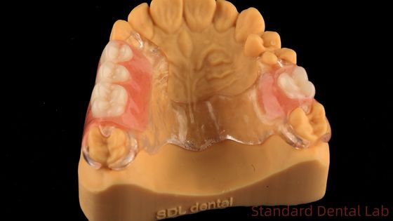 Flexible marco de metal fundido transparente dentaduras parciales alta estética ajuste perfecto