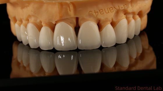 Coronas de laboratorio dentales de contorno completo de alta translucidez Coronas sólidas de zirconia de laboratorio dental chino