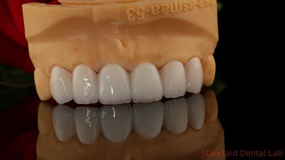 Coroneta de zirconio de contorno completo translúcido 3D PRO sin recubrimiento de porcelana Laboratorio dental estándar