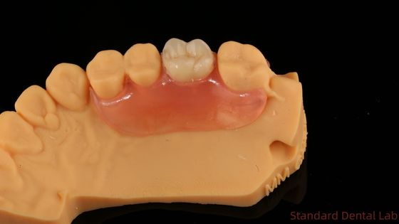 Dental TCS Valplast Flexible Dentes parciales Nesbit Valplast Finish China Valplast cerradura de laboratorio dental