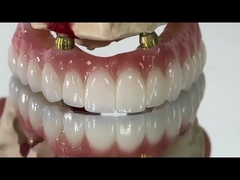 Dental Todo sobre X Implante PFM Corona Titanio Fijación de la prótesis híbrida