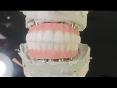 Porcelana todo en cuatro puente de zircónía alta estética puente de implantes dentales