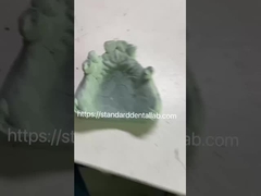 Cuadro de dentadura parcial de metal co-Cr para profesionales dentales