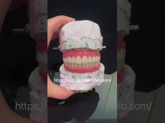 Porcelana profesional de alta estética todo en 4 implantes dentales de puente de zirconia